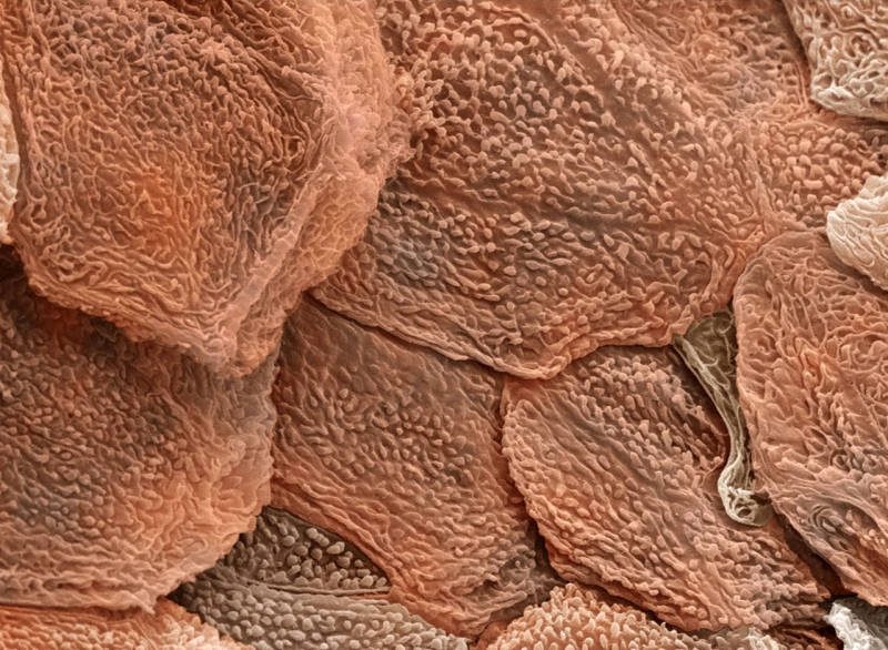 epidermis-sb3849-xl