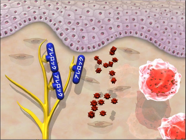 allelock-histamin-float-screenshot